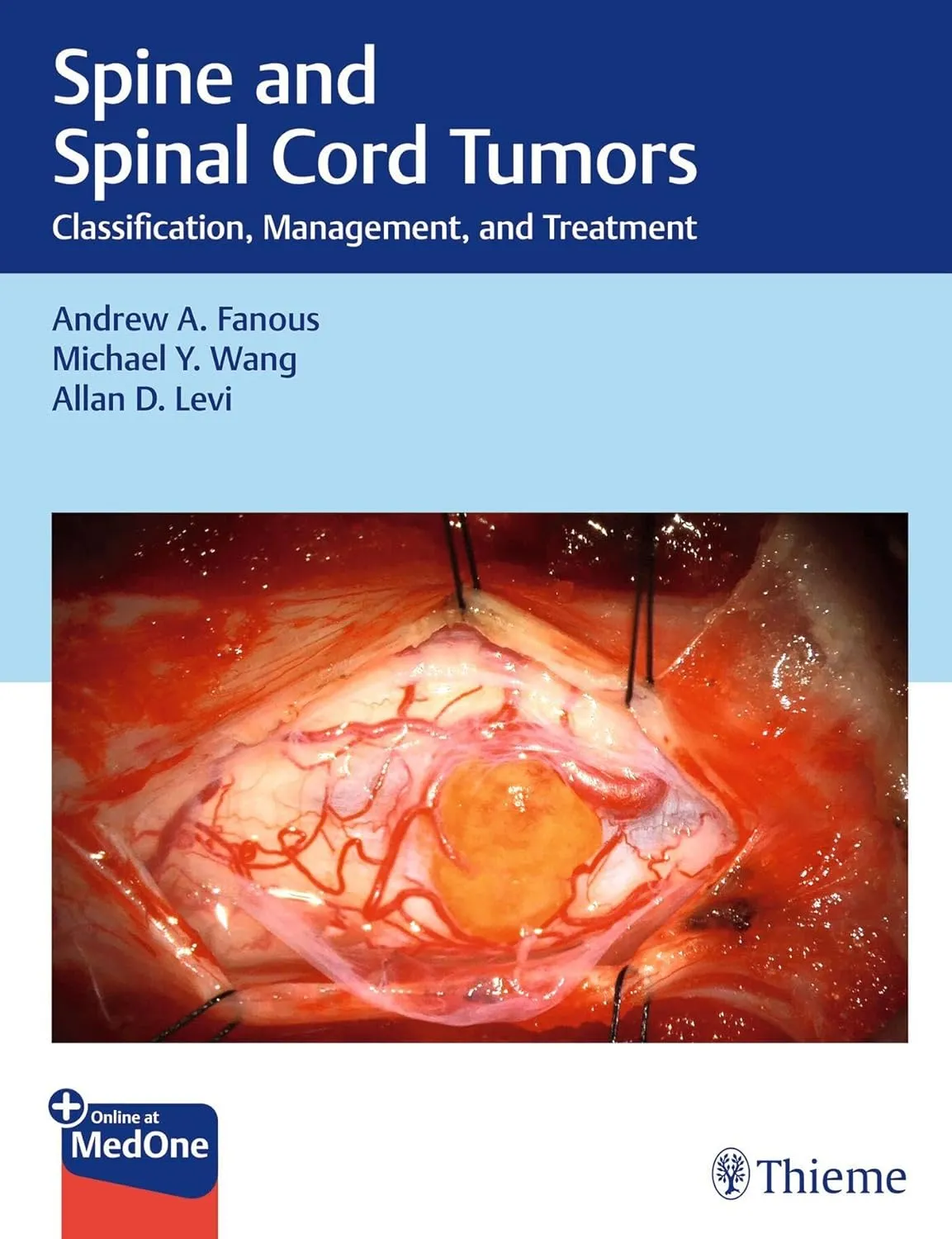 Spine and Spinal Cord Tumors : Classification, Management, and Treatment 1st Ed.