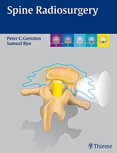 Spine Radiosurgery - 1st Edition