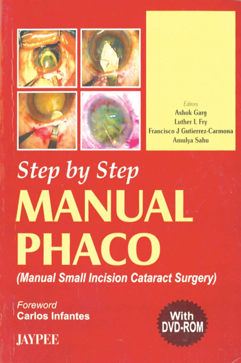 Step By Step Manual Phaco with Dvd-rom - 1st Edition