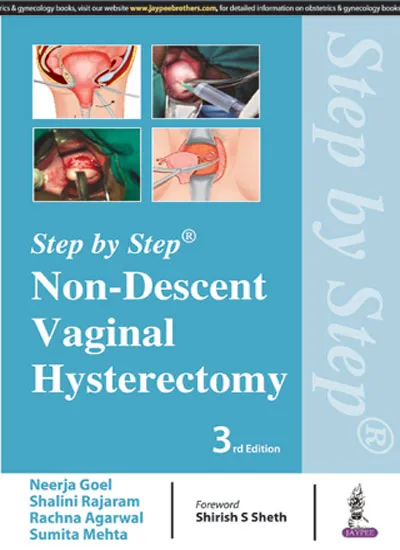 Step By Step Non-descent Vaginal Hysterectomy - 3rd Edition