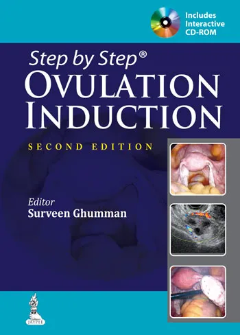 Step By Step Ovulation Induction with Cd-rom - 2nd Edition