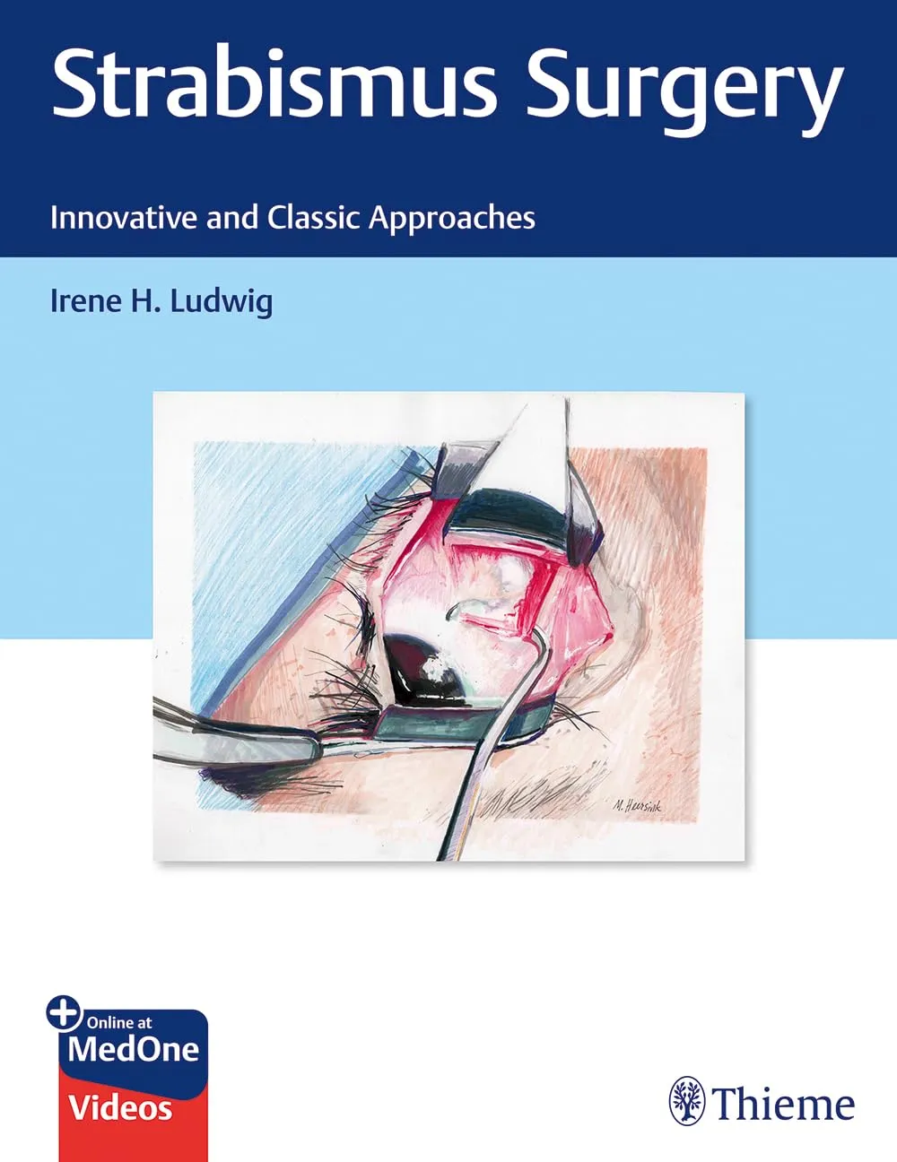 Strabismus Surgery : Innovative and Classic Approaches 1st Ed.