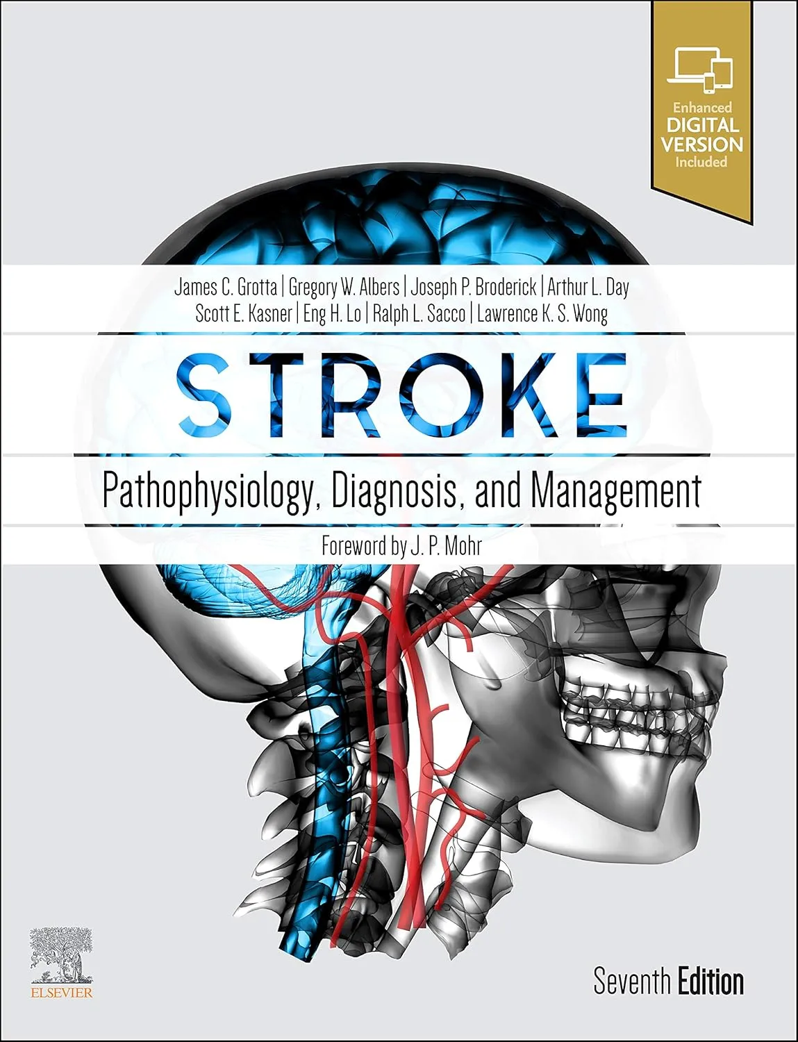 Stroke: Pathophysiology, Diagnosis, and Management -7E
