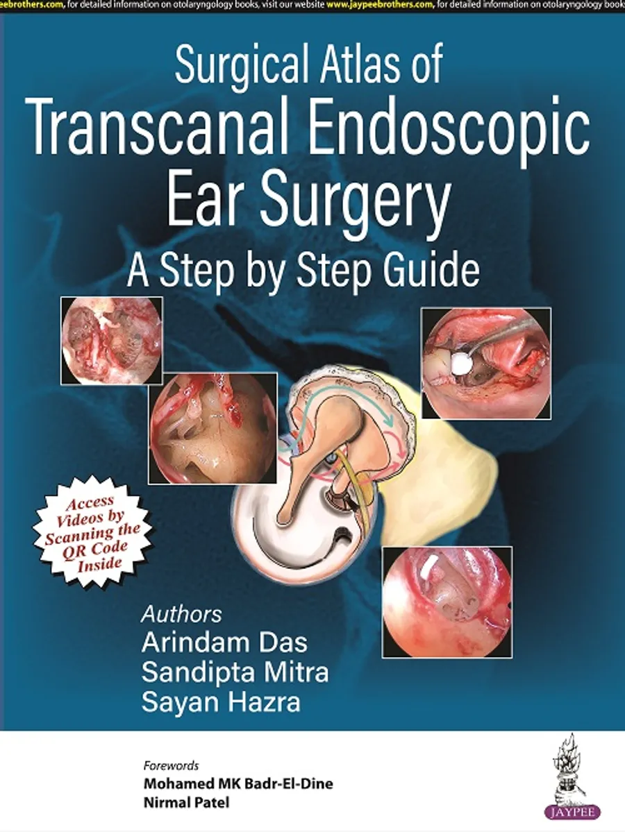 Surgical Atlas of Transcanal Endoscopic Ear Surgery | A Step by Step Guide