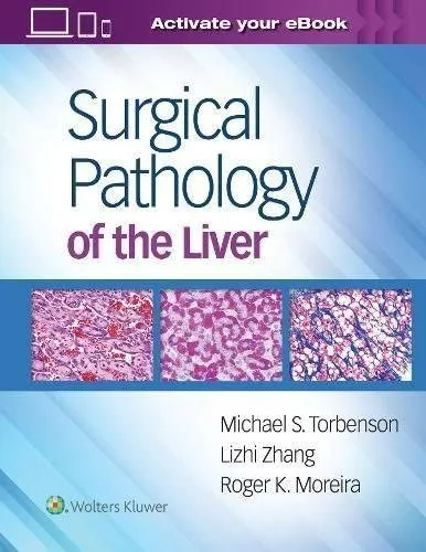 Surgical Pathology of the Liver | 1st Edition