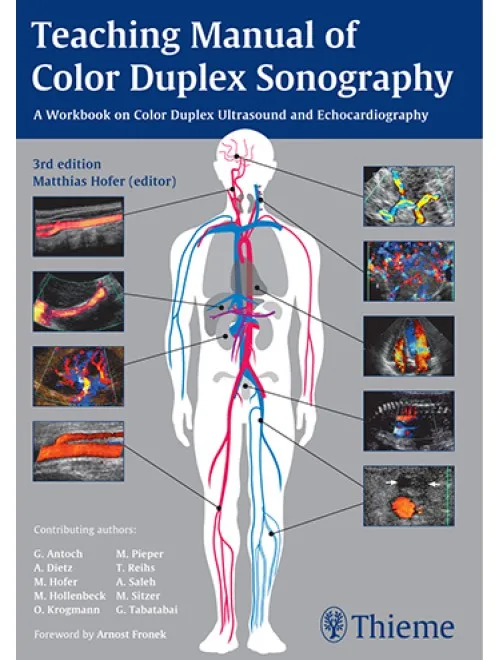 Teaching Manual of Color Duplex Sonography - 3rd Edition