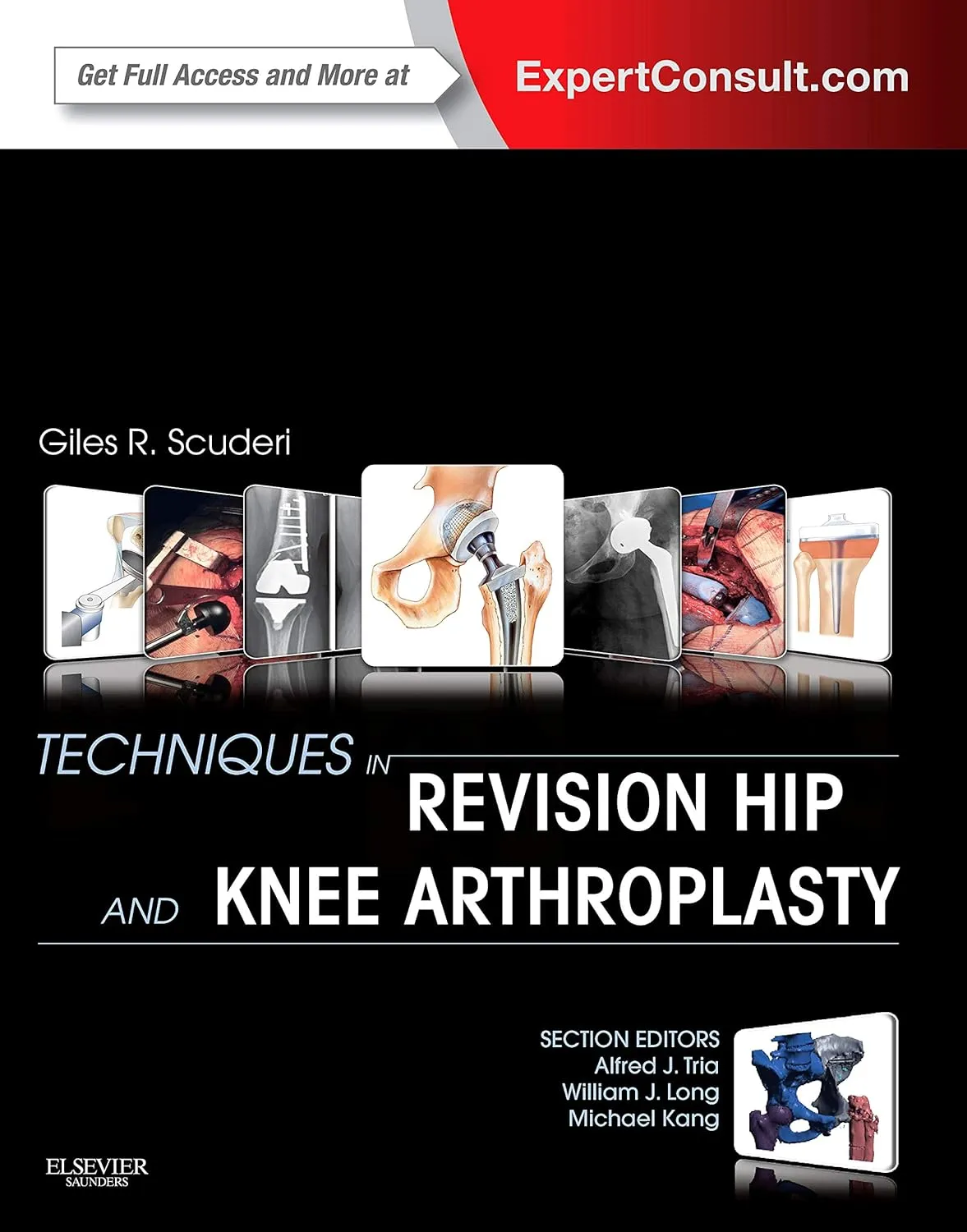 Techniques in Revision Hip& Knee Arthroplasty-1E