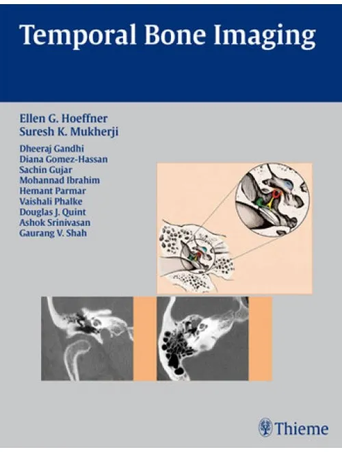 Temporal Bone Imaging - 1st Edition