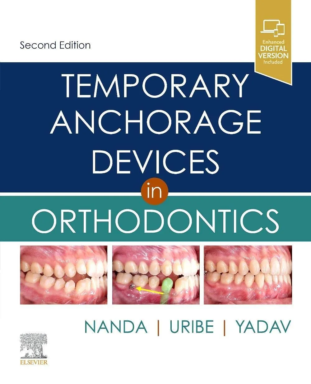 Temporary Anchorage Devices in Orthodontics - 2E