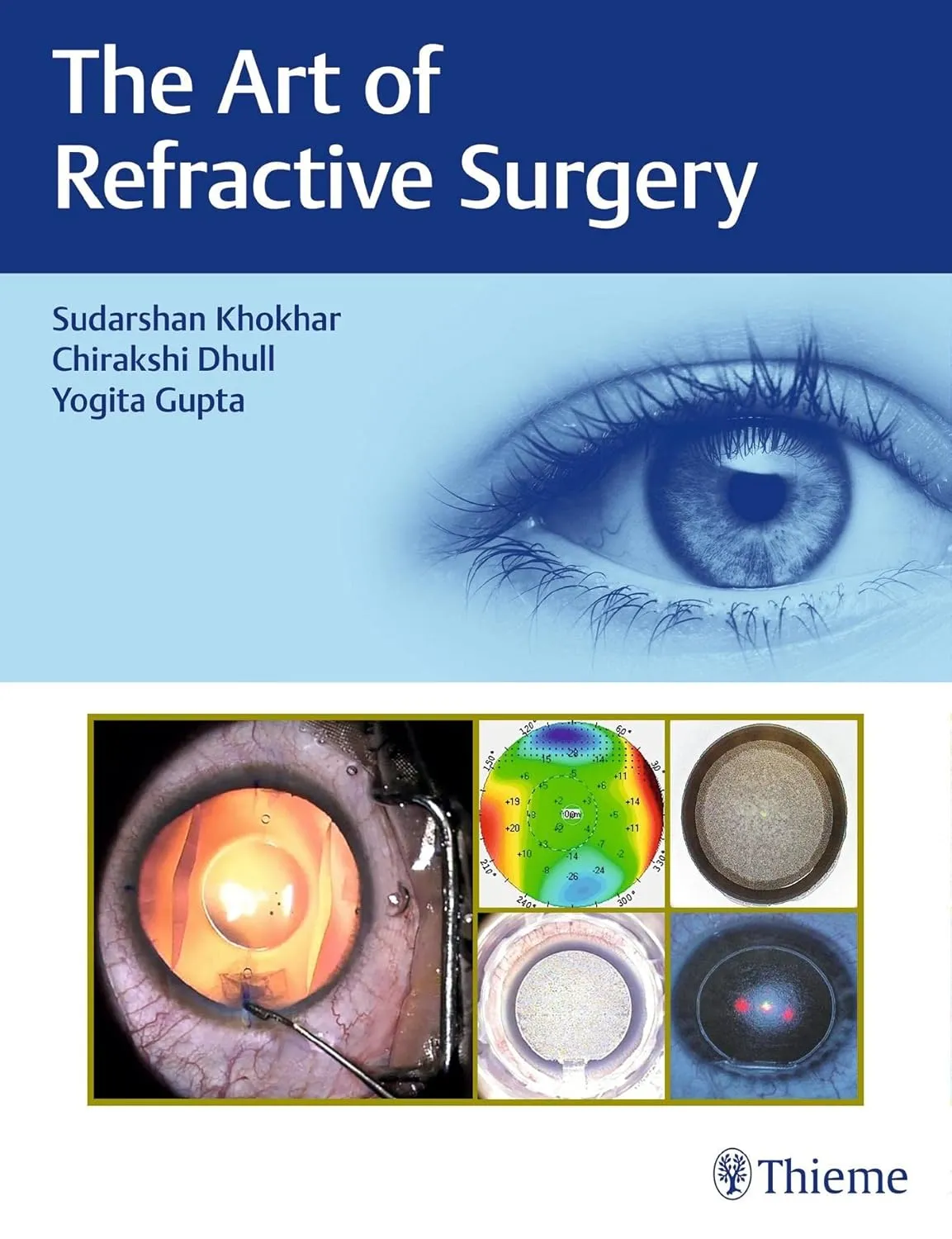 The Art of Refractive Surgery 1st Ed.