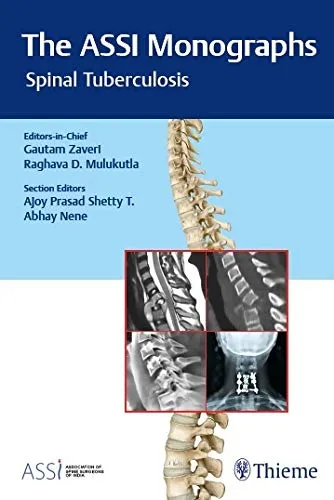 The ASSI Monographs—Spinal Tuberculosis