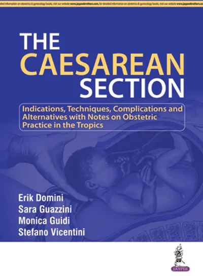 The Caesarean Seciton - 1st Edition
