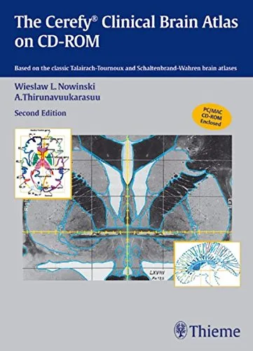 The Cerefy Clinical Brain Atlas/CD-ROM 2004 - 2nd Edition