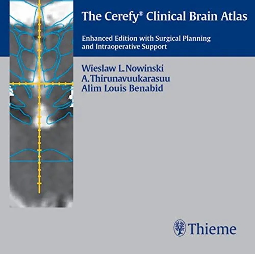 The Cerefy Clinical Brain Atlas/CD-ROM - 2nd Edition