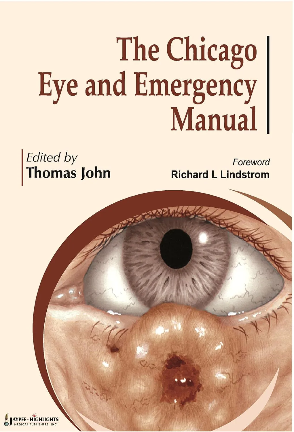 The Chicago Eye And Emergency Manual (Online Edition) - 1st Edition 2011