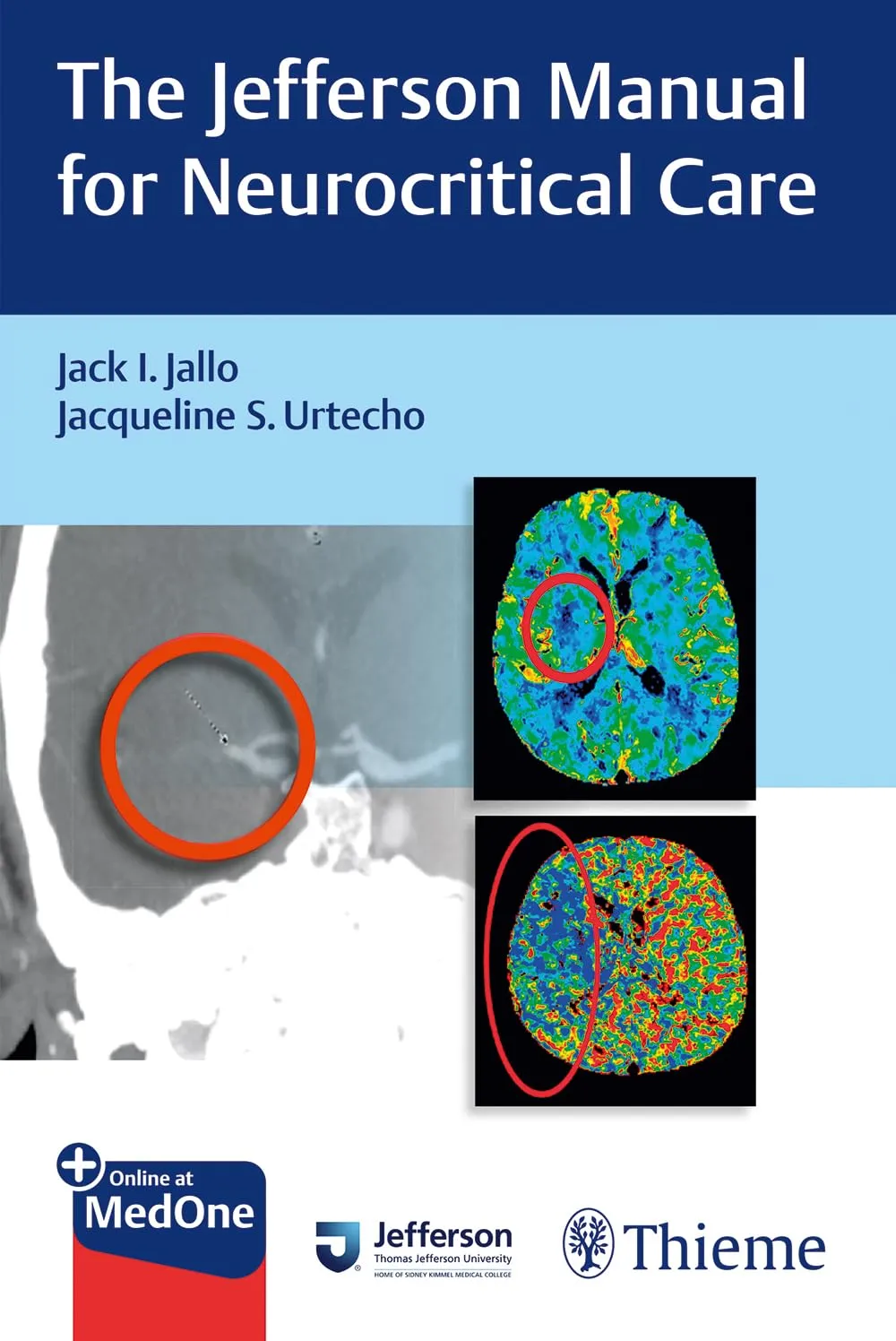 The Jefferson Manual for Neurocritical Care 1st Ed.