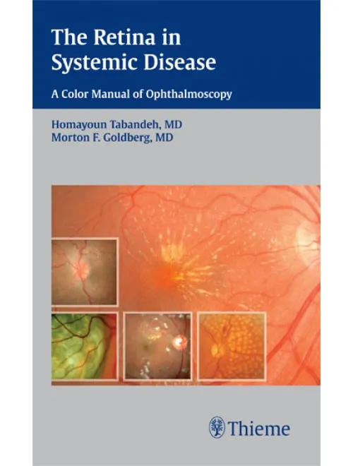 The Retina in Systemic Disease - 1st Edition