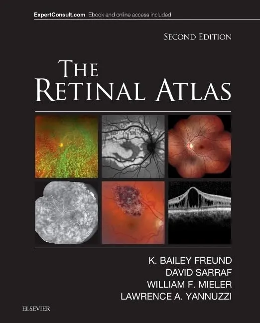 The Retinal Atlas - 2E
