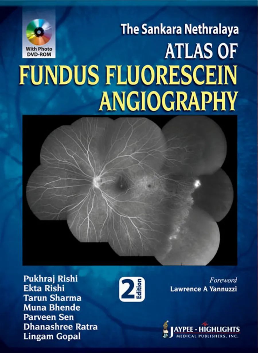 The Sankara Nethralaya | Atlas of Fundus Fluorescein Angiography