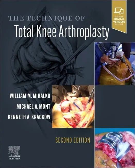The Technique of Total Knee Arthroplasty-2E
