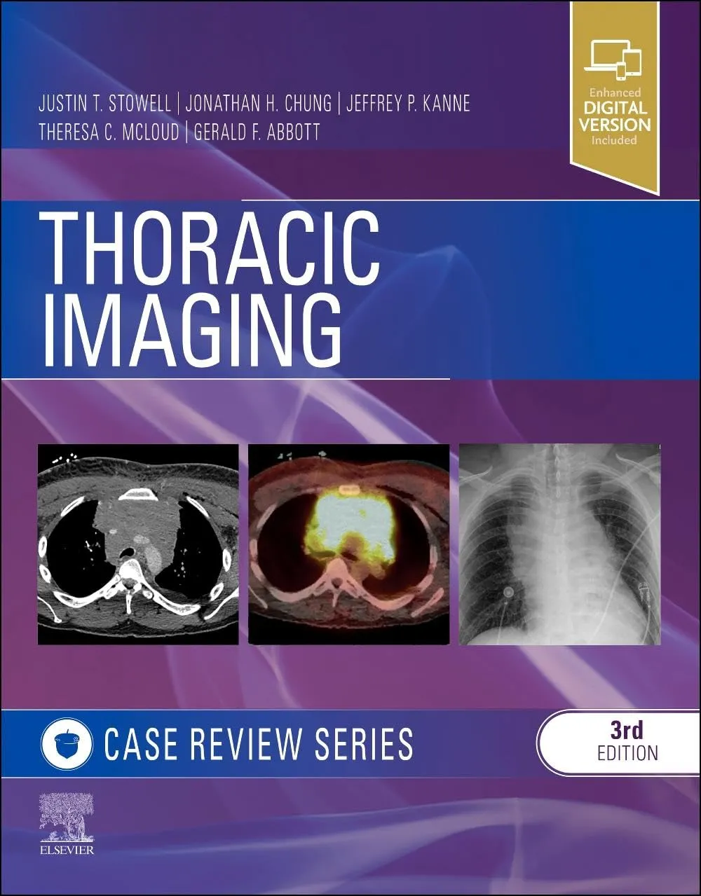 Thoracic Imaging: Case Review - 3E