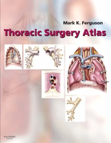 Image of as