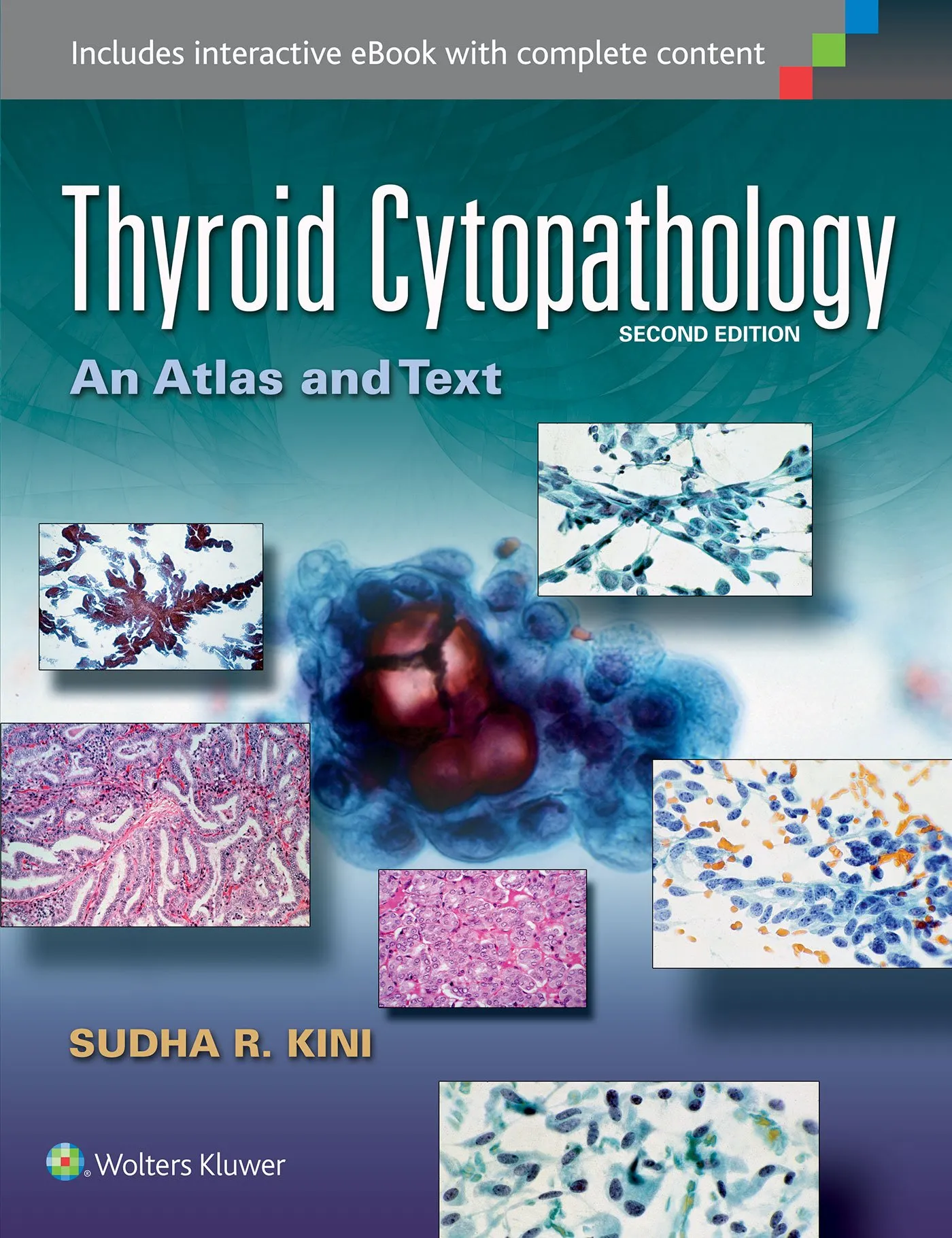 Thyroid Cytopathology:A Text and Atlas | 2nd Edition