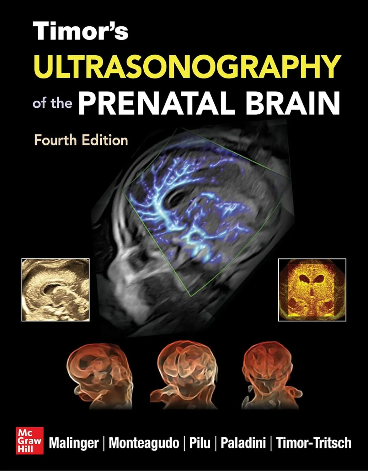 Ultrasonography of the Prenatal Brain -4E