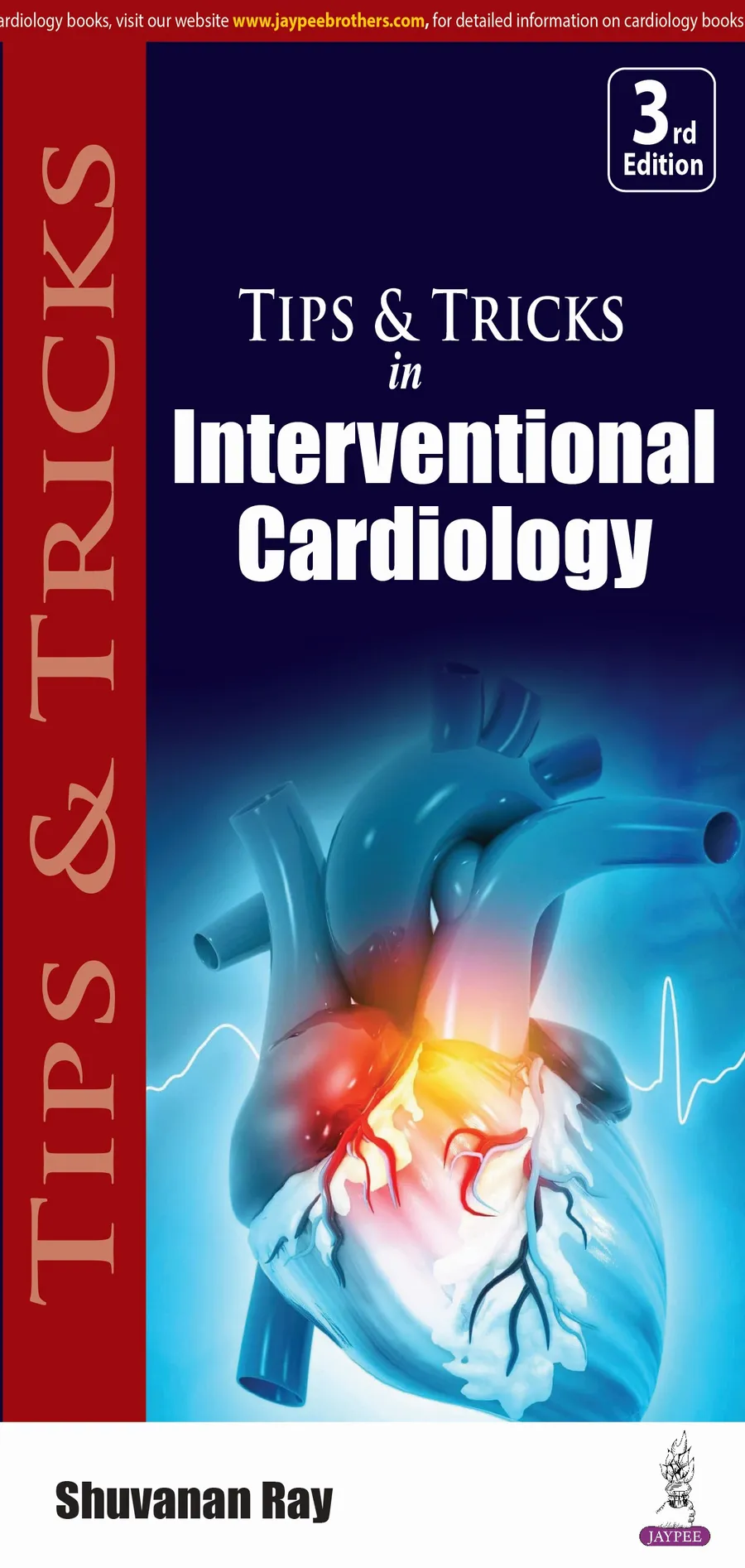 Image of Tips & Tricks In Interventional Cardiology
