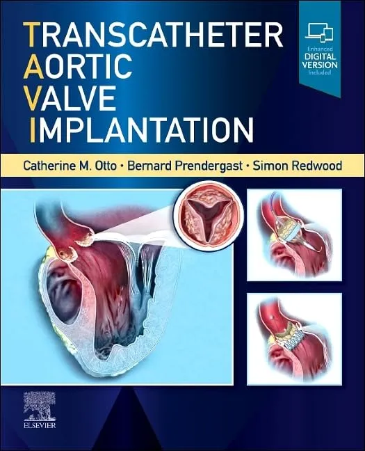 Image of Transcatheter Aortic Valve Implantation - 1E