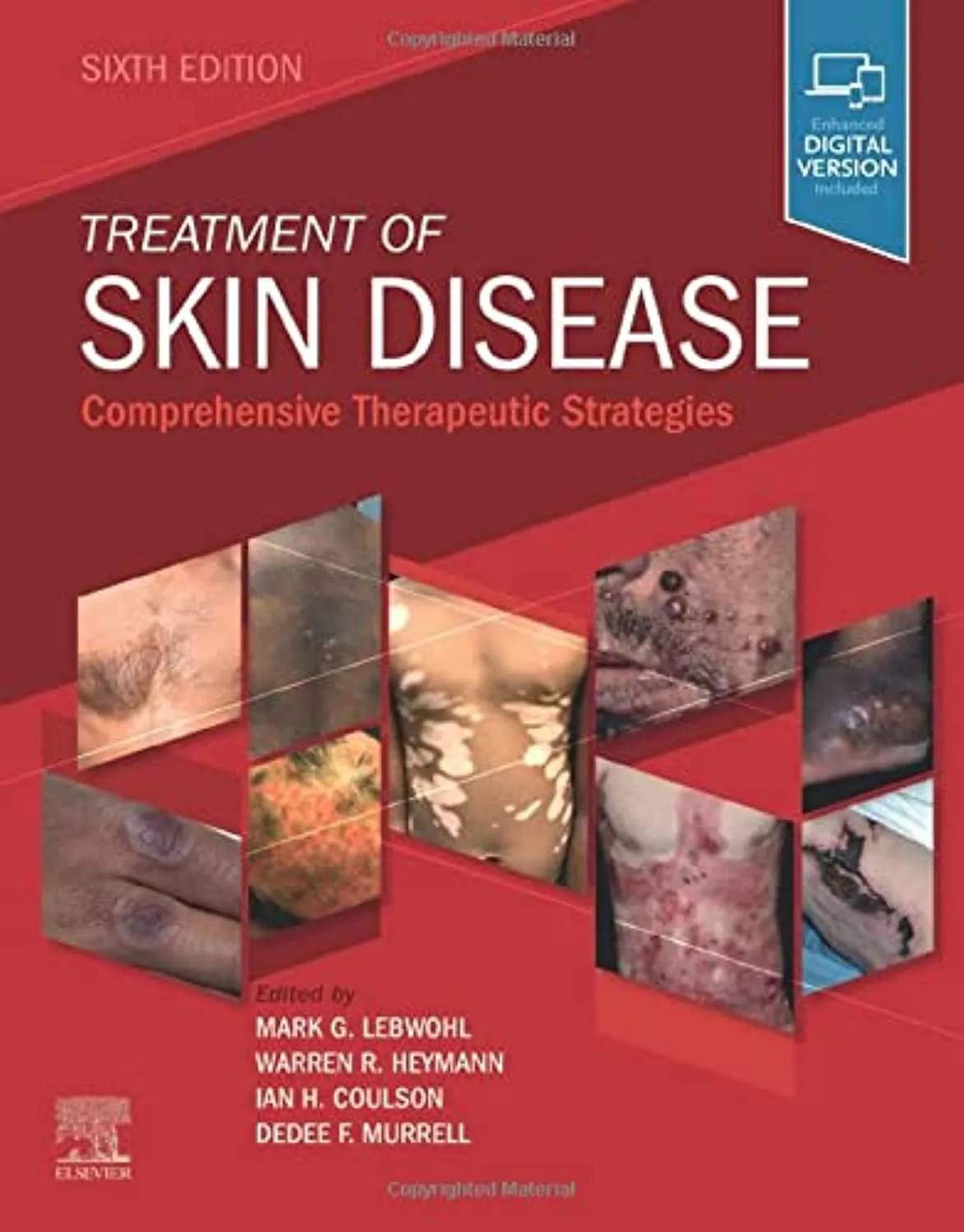 Treatment of Skin Disease Comprehensive Therapeutic Strategies - 6th Edition