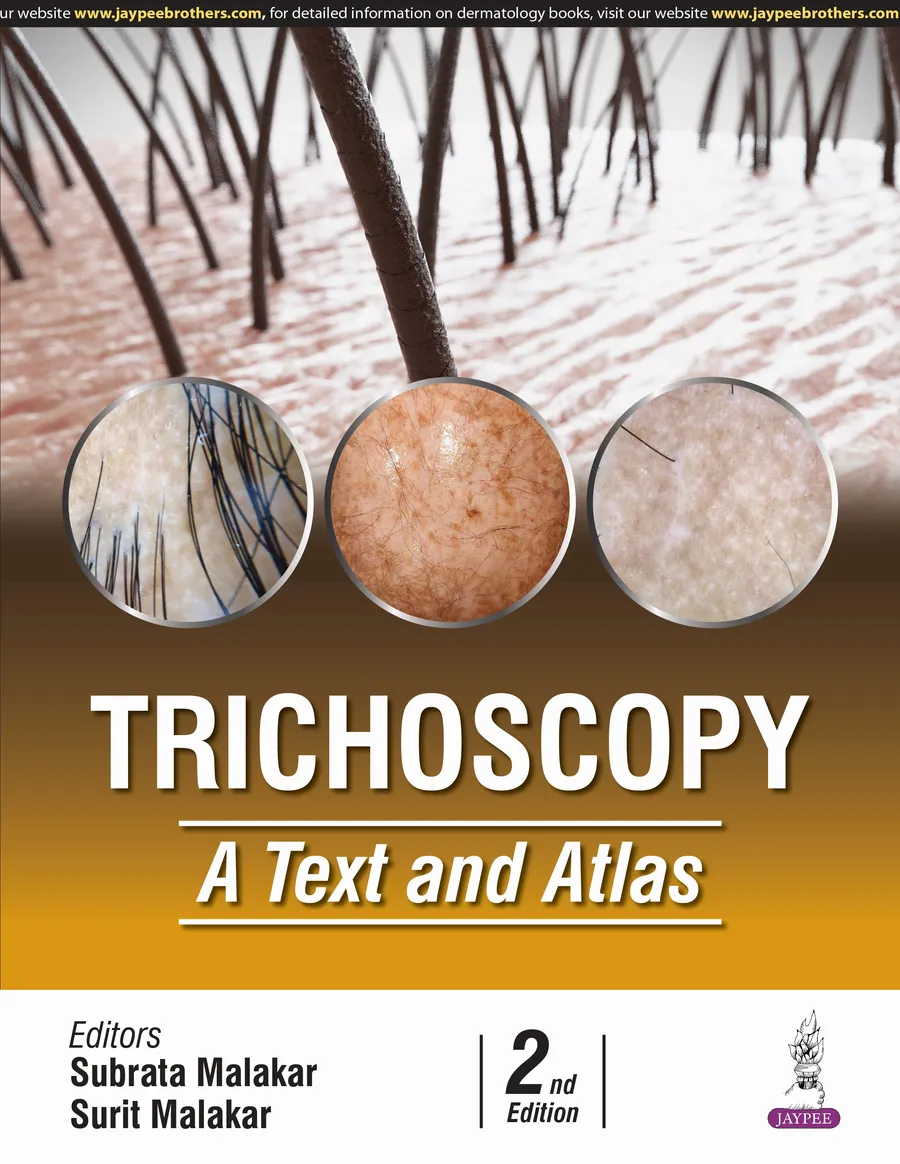 Trichoscopy | A Text and Atlas