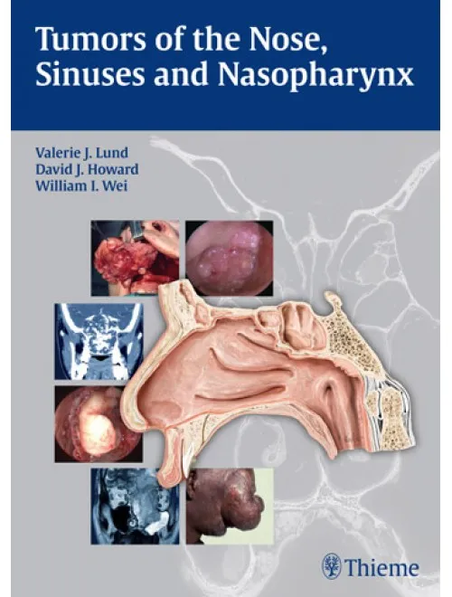 Tumors of The Nose , Sinuses, and Nasopharynx - 1st Edition