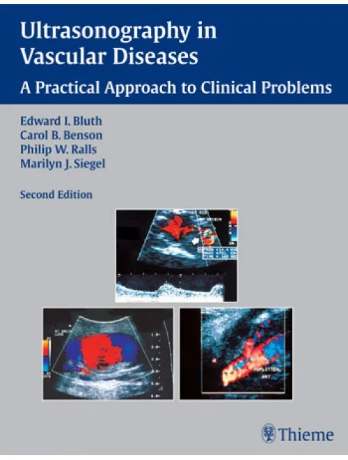 Ultrasonography in Vascular Diseases - 2nd Edition
