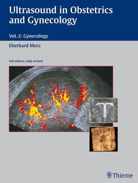 Ultrasound in Obstetrics and Gynecology Volume 2 G
