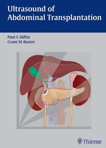 Ultrasound of Abdominal Transplantation - 1st Edition