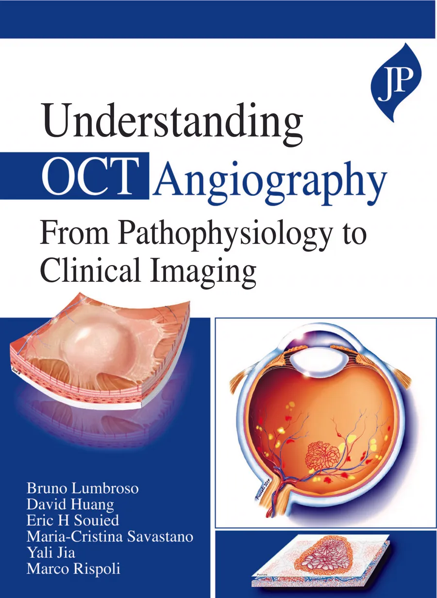 Understanding OCT Angiography From Pathophysiology to Clinical Imaging