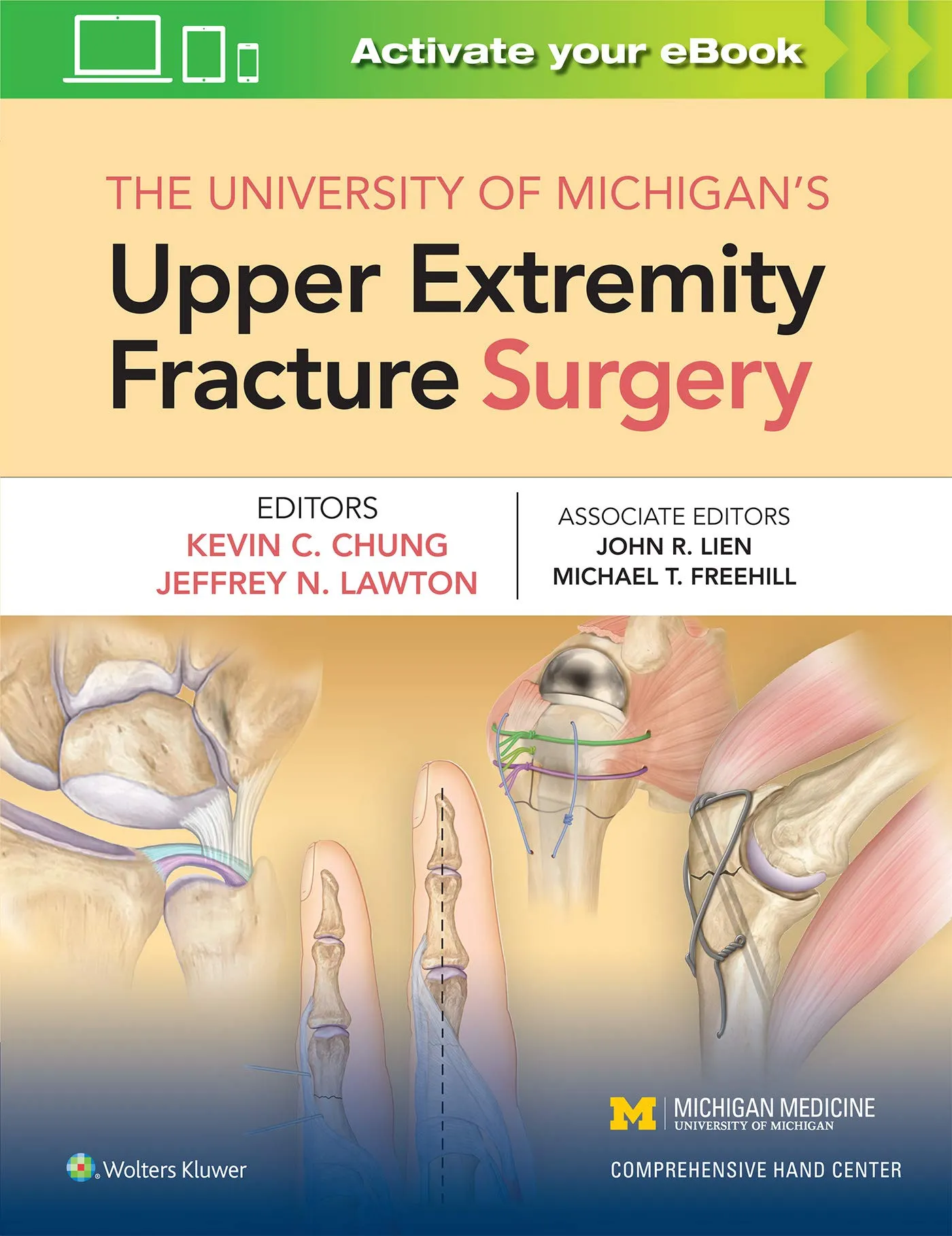 The University of Michigans Upper Extremity Fracture Surgery - 1st Edition