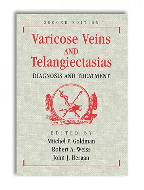 Varicose Veins and Telangiectasias: Diagnosis and Treatment - 2nd Edition