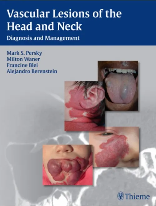Vascular Lesions of the Head and Neck - 1st Edition