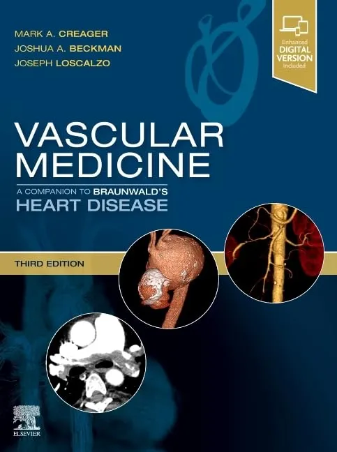 Image of Vascular Medicine: A Companion to Braunwald's Heart Disease: Expert Consult - Online and Print - 3E
