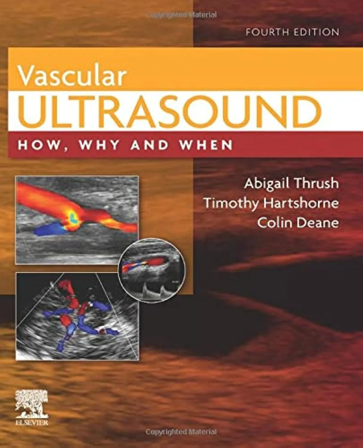 Vascular Ultrasound - How Why and When - 4E