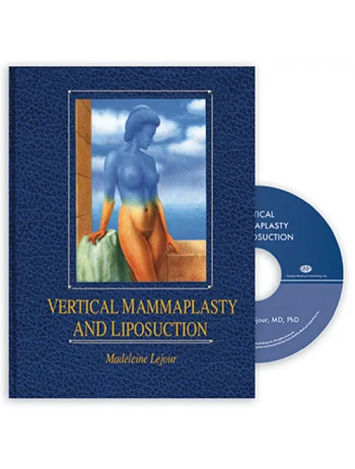 Vertical Mammaplasty and Liposuction - 1st Edition
