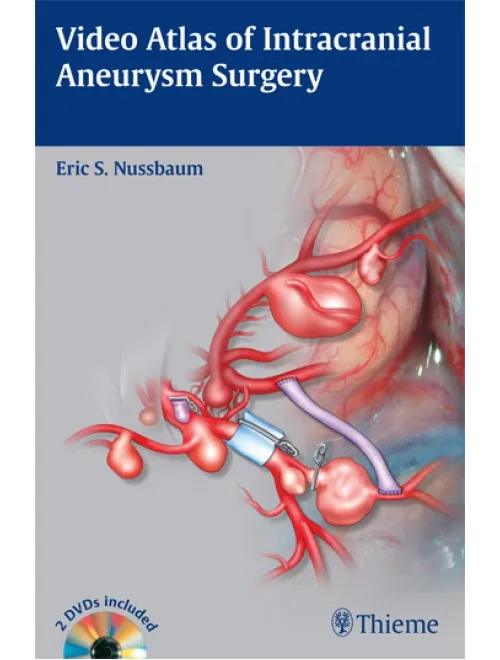 Video Atlas of Intracranial Aneurysm Surgery - 1st Edition