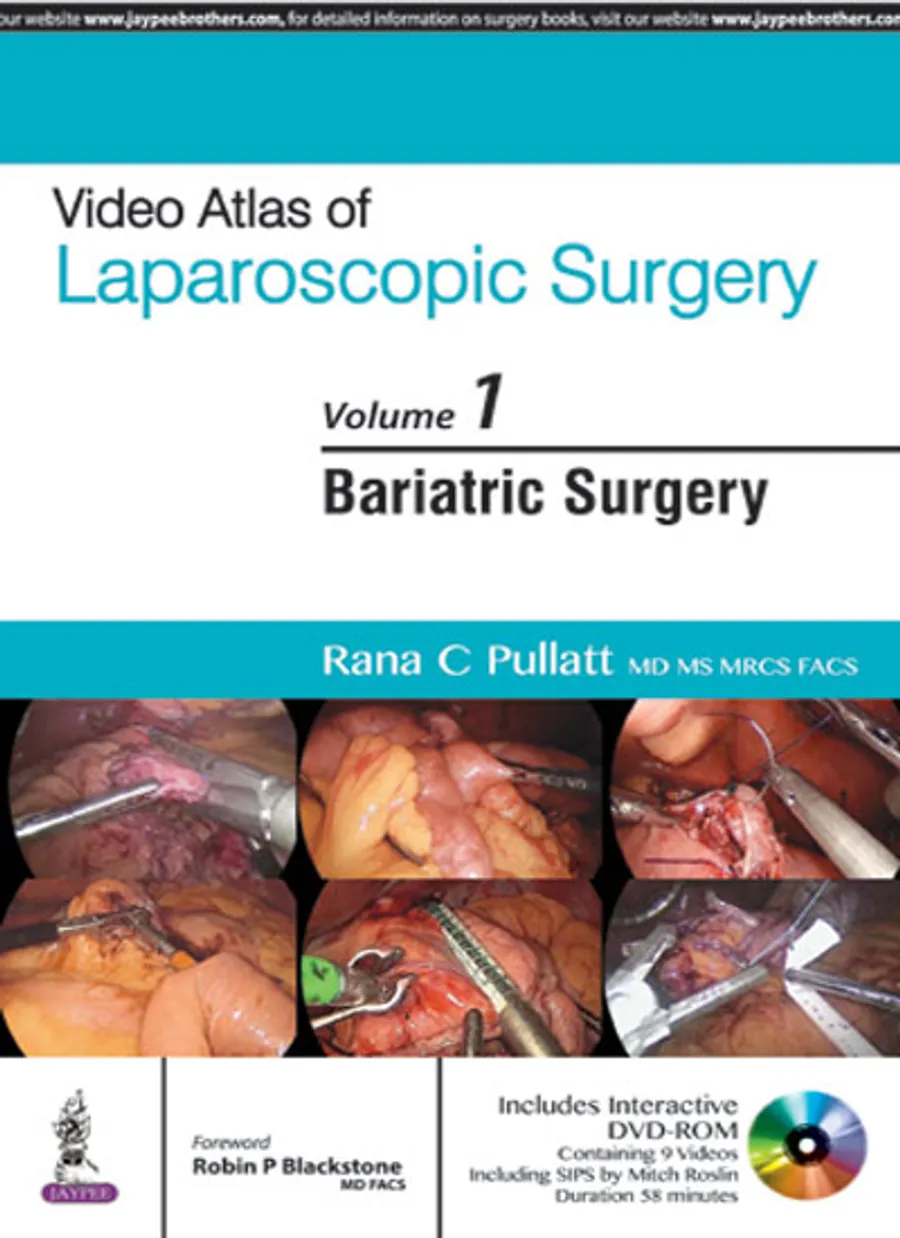 Video Atlas of Laparoscopic SurgeryâBariatric Surgery (Vol. 1) Includes Interactive DVD-ROM