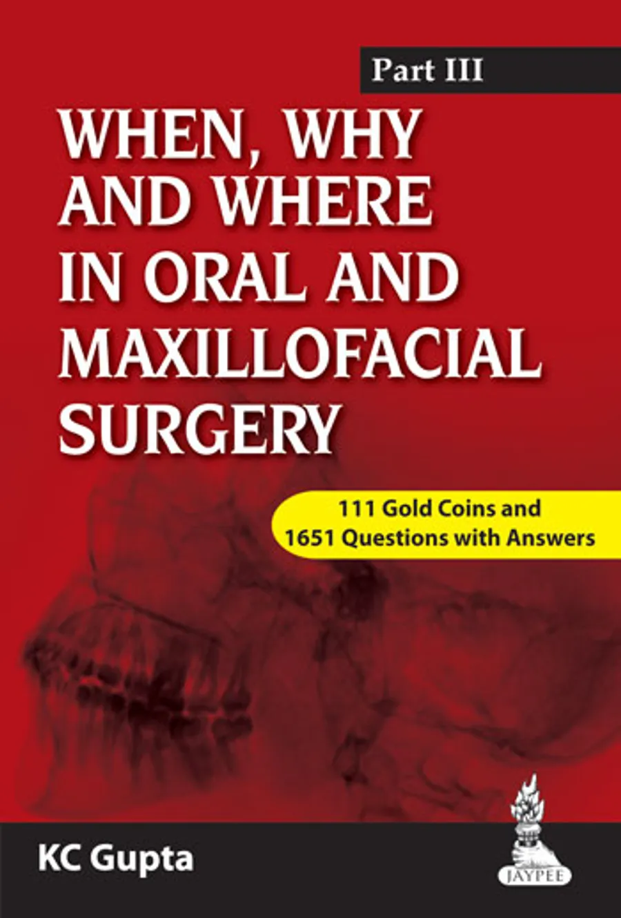 When, Why and Where in Oral and Maxillofacial Surgery | Prep Manual for Undergraduates and Postgraduates Part-III