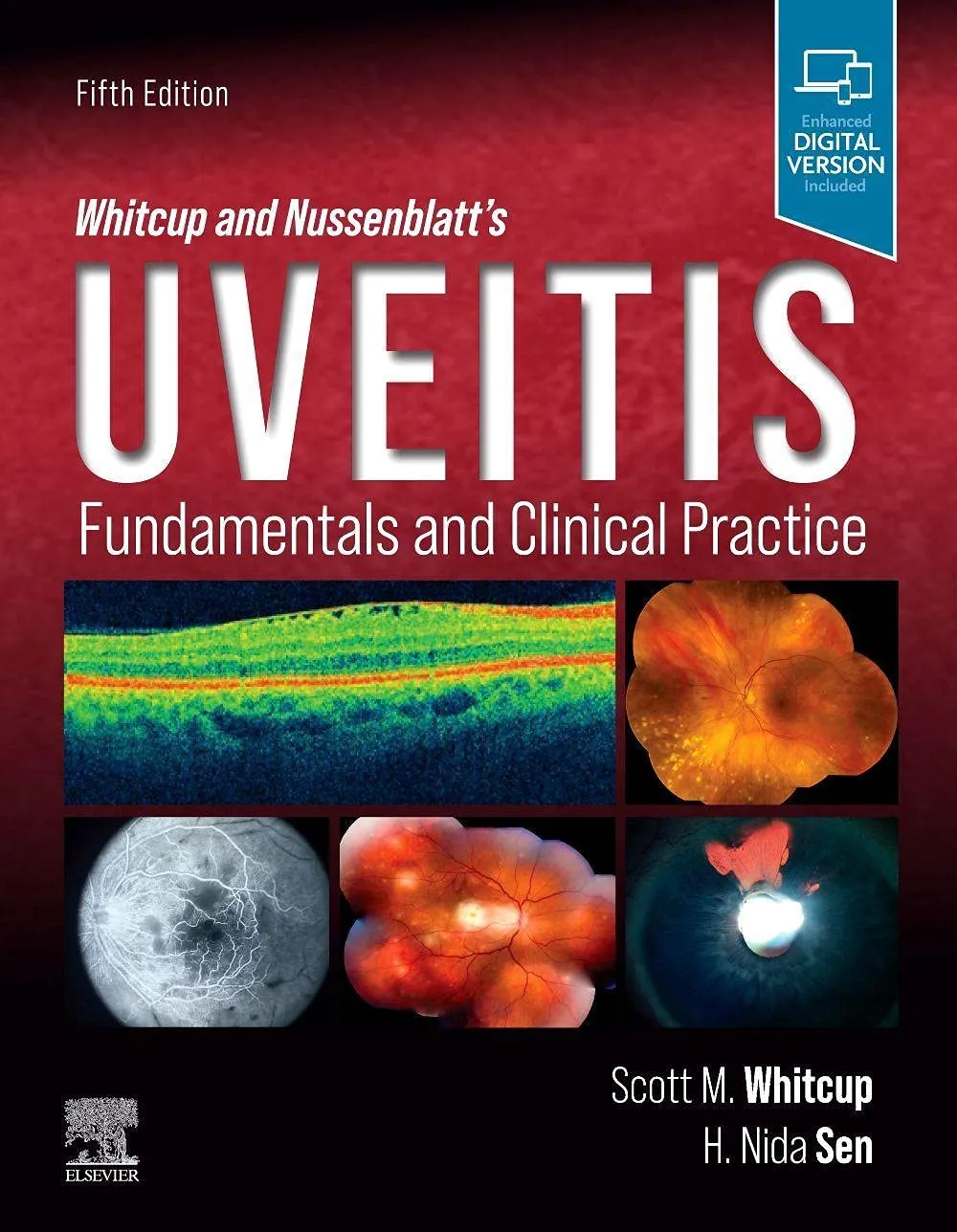 Whitcup and Nussenblatt's Uveitis-5E
