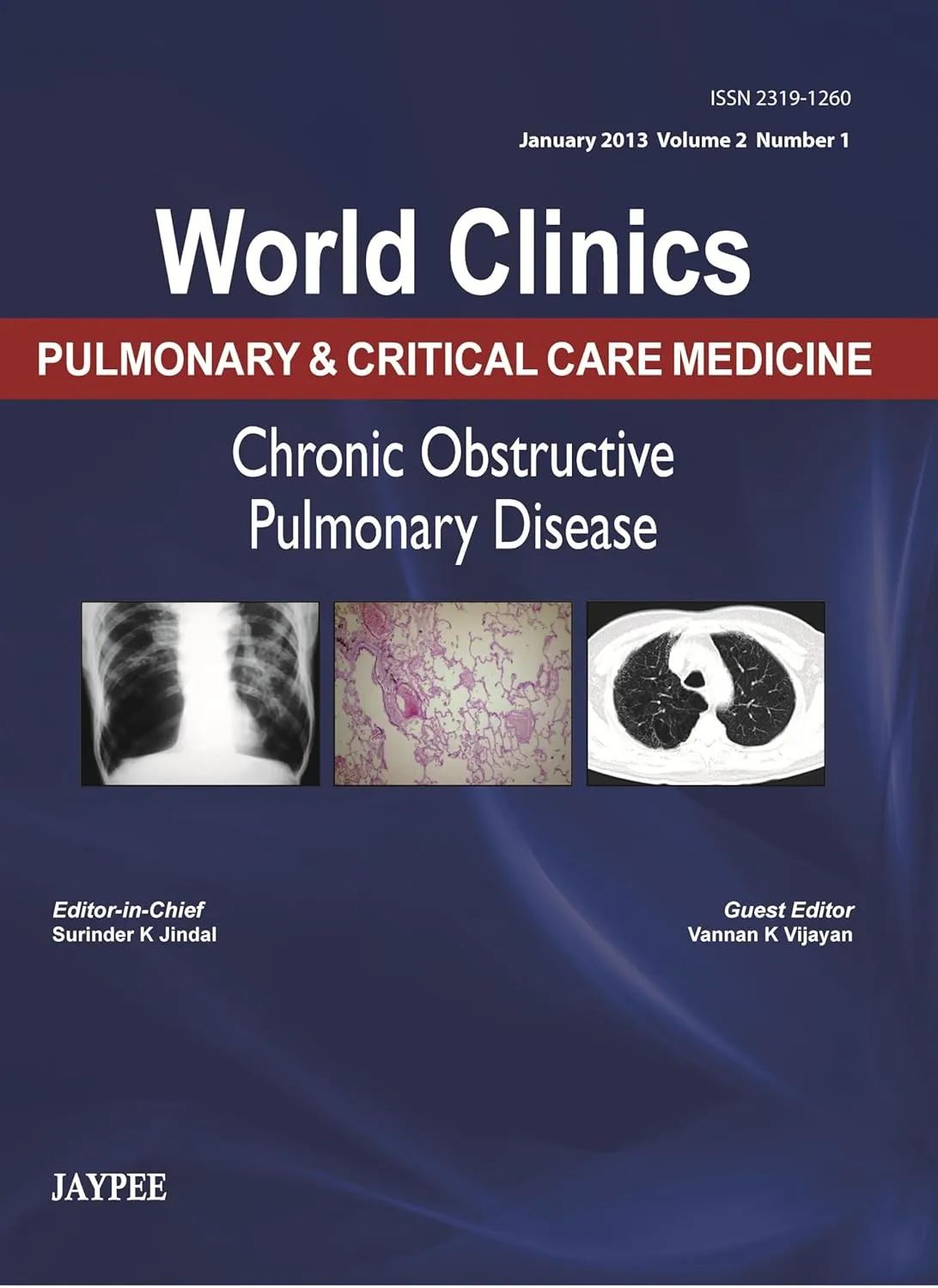 World Clinics-Pulmonary and Critical Care Medicine: Pneumonias - Vol-1, Issue-1 2013