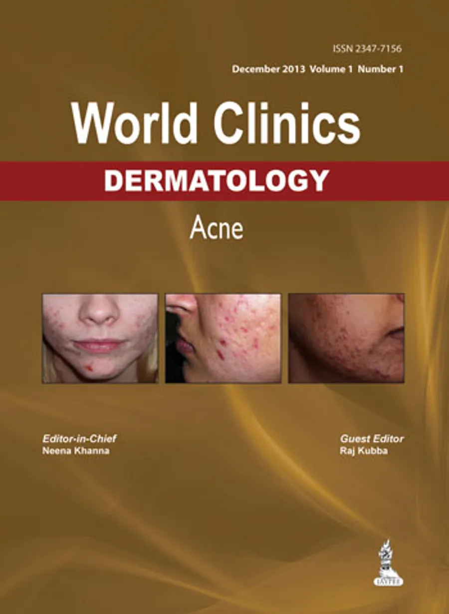World Clinics | Dermatology - Acne(December 2013 Volume 1 Number 1)
